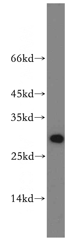 SKOV-3 cells were subjected to SDS PAGE followed by western blot with Catalog No:115571(SPIN1 antibody) at dilution of 1:500