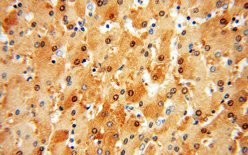 Immunohistochemical of paraffin-embedded human liver using Catalog No:115492(SOD1 antibody) at dilution of 1:100 (under 40x lens)