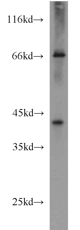 Jurkat cells were subjected to SDS PAGE followed by western blot with Catalog No:110949(GFOD2 antibody) at dilution of 1:500