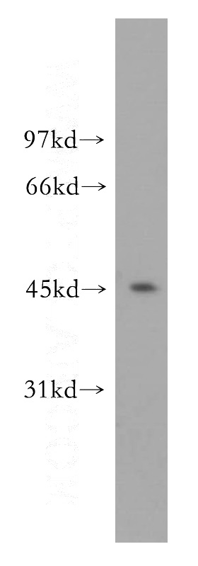 HeLa cells were subjected to SDS PAGE followed by western blot with Catalog No:113421(ORC4L antibody) at dilution of 1:500