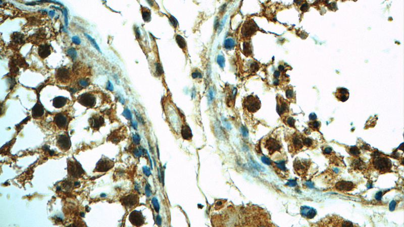 Immunohistochemistry of paraffin-embedded human testis tissue slide using Catalog No:107620(TFIP11 Antibody) at dilution of 1:50