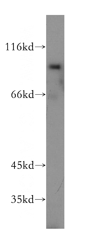 HeLa cells were subjected to SDS PAGE followed by western blot with Catalog No:115608(SSH3 antibody) at dilution of 1:800