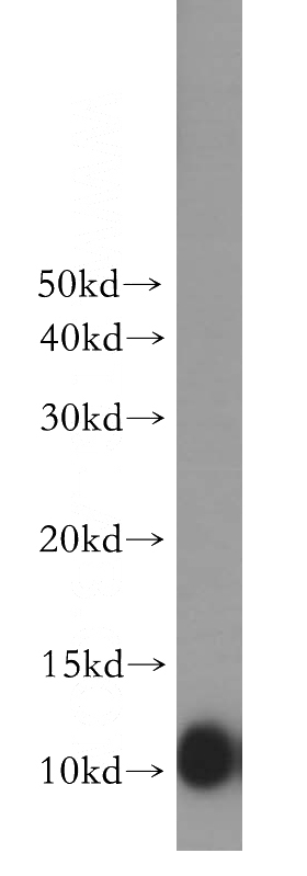 human brain tissue were subjected to SDS PAGE followed by western blot with Catalog No:107934(AKAP7 antibody) at dilution of 1:500