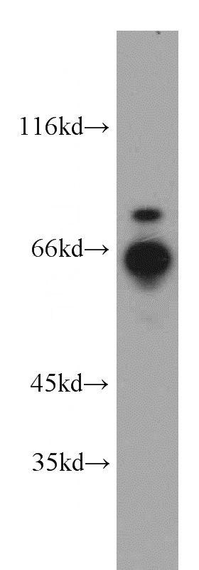 HepG2 cells were subjected to SDS PAGE followed by western blot with Catalog No:114746(RNF168 antibody) at dilution of 1:500