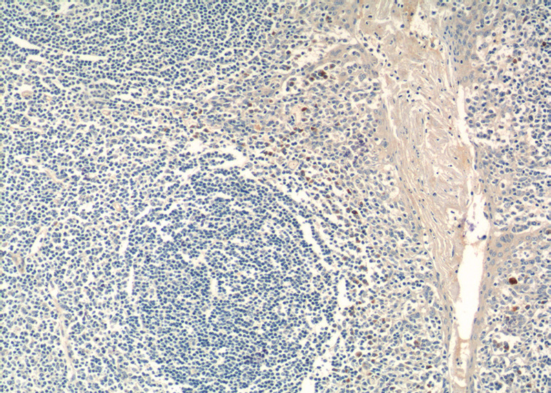 Immunohistochemistry of paraffin-embedded human tonsillitis tissue slide using Catalog No:113741(PCM1 Antibody) at dilution of 1:50 (under 10x lens)