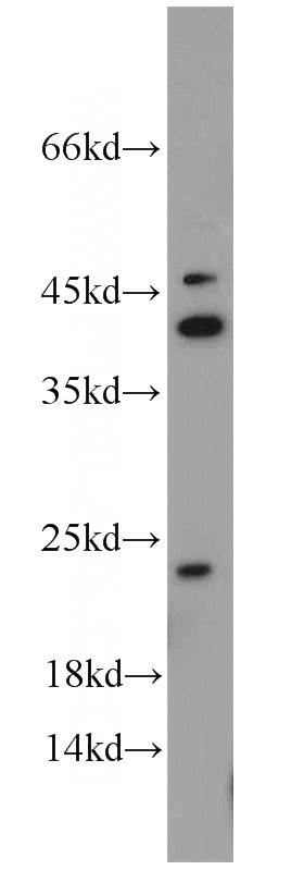 HeLa cells were subjected to SDS PAGE followed by western blot with Catalog No:108222(ASF1A antibody) at dilution of 1:600