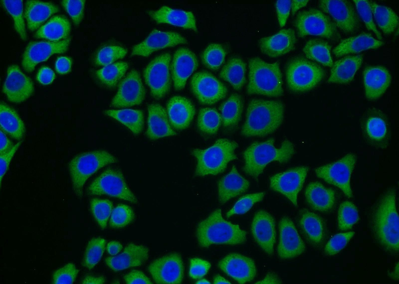 Immunofluorescent analysis of PC-3 cells using Catalog No:108924(CAMKK2 Antibody) at dilution of 1:25 and Alexa Fluor 488-congugated AffiniPure Goat Anti-Rabbit IgG(H+L)
