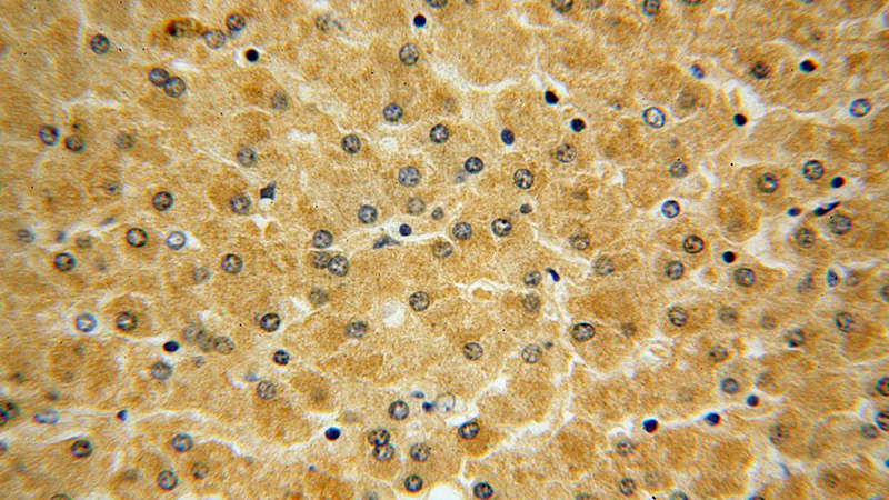 Immunohistochemical of paraffin-embedded human liver using Catalog No:111183(GSTCD antibody) at dilution of 1:100 (under 40x lens)