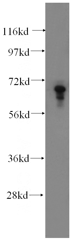 HepG2 cells were subjected to SDS PAGE followed by western blot with Catalog No:113882(PIAS3 antibody) at dilution of 1:300