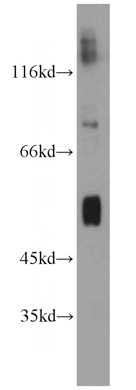 human brain tissue were subjected to SDS PAGE followed by western blot with Catalog No:108298(ATG4D antibody) at dilution of 1:800
