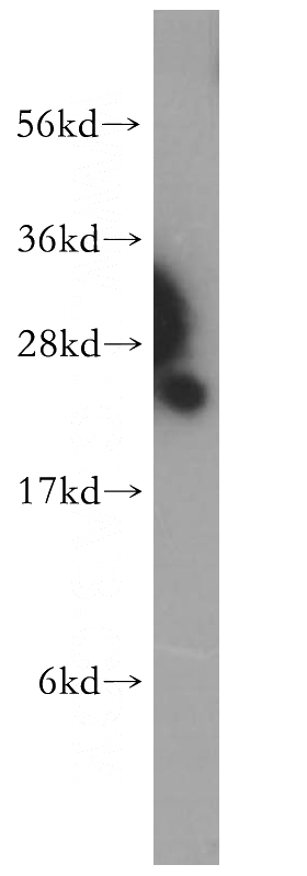 HeLa cells were subjected to SDS PAGE followed by western blot with Catalog No:114379(PSMB1 antibody) at dilution of 1:500