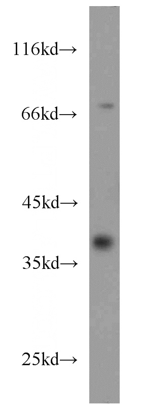 human kidney tissue were subjected to SDS PAGE followed by western blot with Catalog No:109104(CDC37L1 antibody) at dilution of 1:500