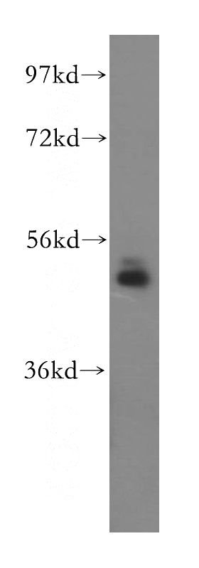 human liver tissue were subjected to SDS PAGE followed by western blot with Catalog No:113353(NudCL antibody) at dilution of 1:300