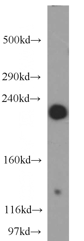 mouse kidney tissue were subjected to SDS PAGE followed by western blot with Catalog No:107900(MLLT4 antibody) at dilution of 1:500