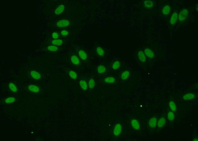 Immunofluorescent analysis of HepG2 cells using Catalog No:110162(EAF2 Antibody) at dilution of 1:50 and Alexa Fluor 488-congugated AffiniPure Goat Anti-Rabbit IgG(H+L)