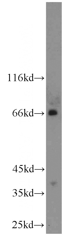 HeLa cells were subjected to SDS PAGE followed by western blot with Catalog No:116433(TSHR antibody) at dilution of 1:1000