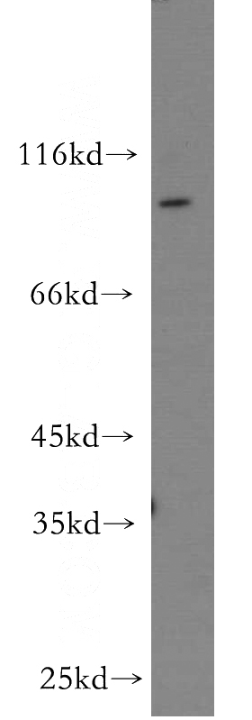mouse brain tissue were subjected to SDS PAGE followed by western blot with Catalog No:110915(MOGS antibody) at dilution of 1:500
