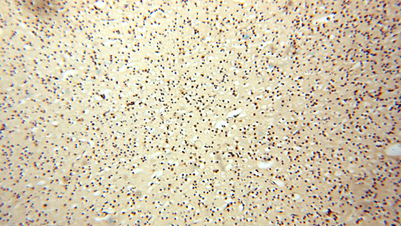 Immunohistochemical of paraffin-embedded human brain using Catalog No:113625(PDK2 antibody) at dilution of 1:100 (under 10x lens)