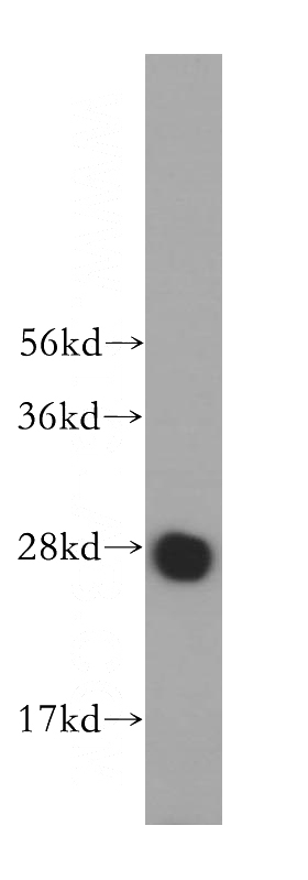 K-562 cells were subjected to SDS PAGE followed by western blot with Catalog No:112587(MED20 antibody) at dilution of 1:500