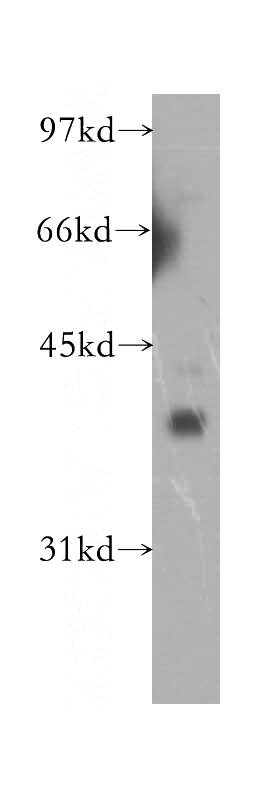 human brain tissue were subjected to SDS PAGE followed by western blot with Catalog No:110919(GDAP1 antibody) at dilution of 1:500