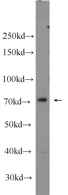 K-562 cells were subjected to SDS PAGE followed by western blot with Catalog No:114230(PRPF39 Antibody) at dilution of 1:1000