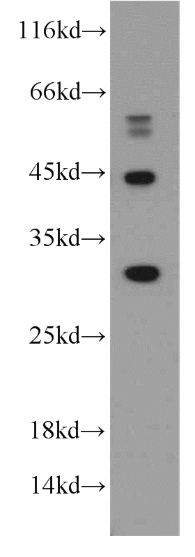 HeLa cells were subjected to SDS PAGE followed by western blot with Catalog No:112691(MMACHC antibody) at dilution of 1:300
