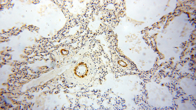 Immunohistochemical of paraffin-embedded human lung using Catalog No:117211(BOLA1 antibody) at dilution of 1:100 (under 10x lens)