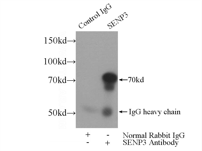 IP Result of anti-SENP3 (IP:Catalog No:115109, 4ug; Detection:Catalog No:115109 1:500) with Y79 cells lysate 2000ug.
