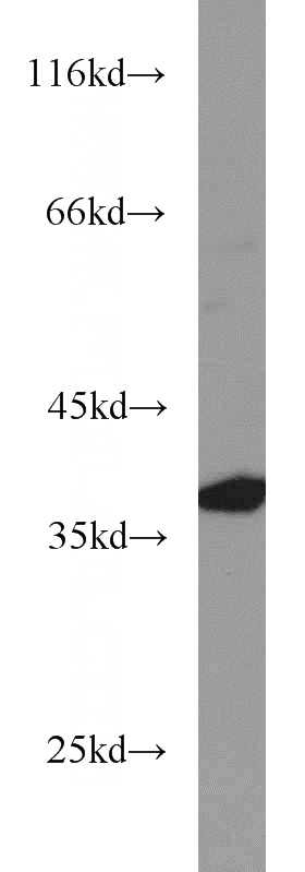 Jurkat cells were subjected to SDS PAGE followed by western blot with Catalog No:115798(STX4 antibody) at dilution of 1:1500