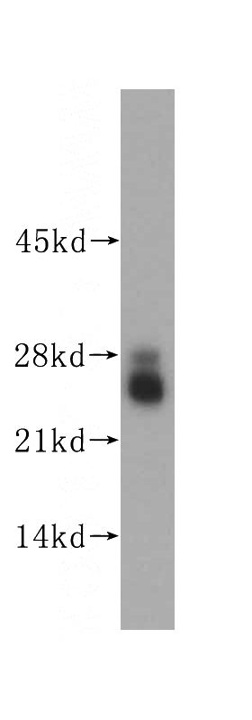 human cerebellum tissue were subjected to SDS PAGE followed by western blot with Catalog No:112238(LIN7C antibody) at dilution of 1:800