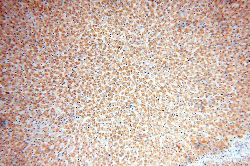 Immunohistochemical of paraffin-embedded human liver using Catalog No:112766(MTCH2 antibody) at dilution of 1:100 (under 10x lens)