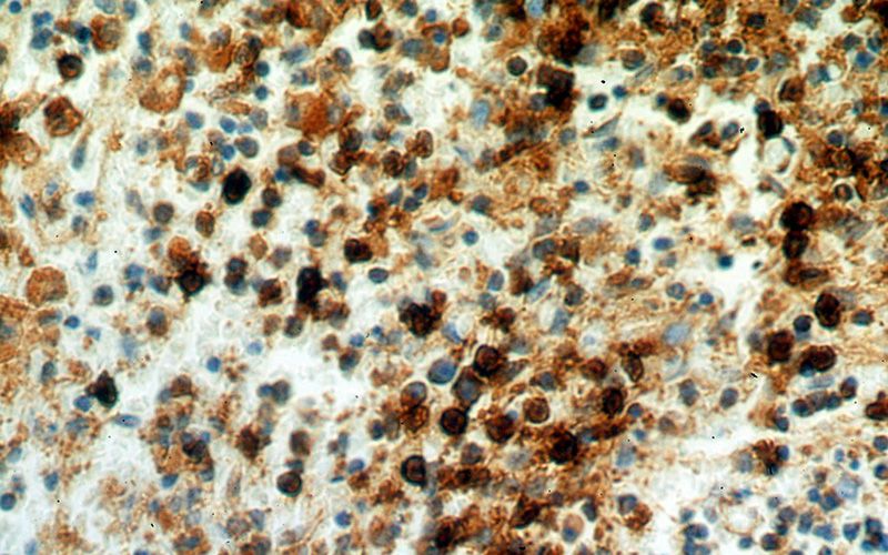 Immunohistochemical of paraffin-embedded human spleen using Catalog No:116247(TOP2A-Specific antibody) at dilution of 1:100 (under 40x lens)