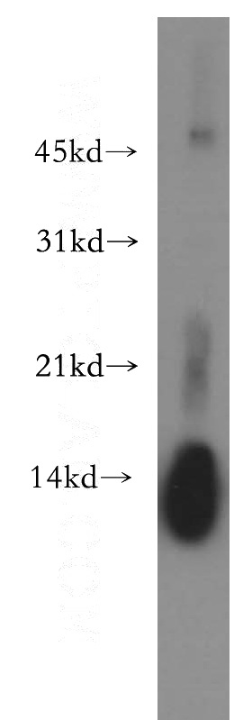human spleen tissue were subjected to SDS PAGE followed by western blot with Catalog No:112414(LYZ antibody) at dilution of 1:400
