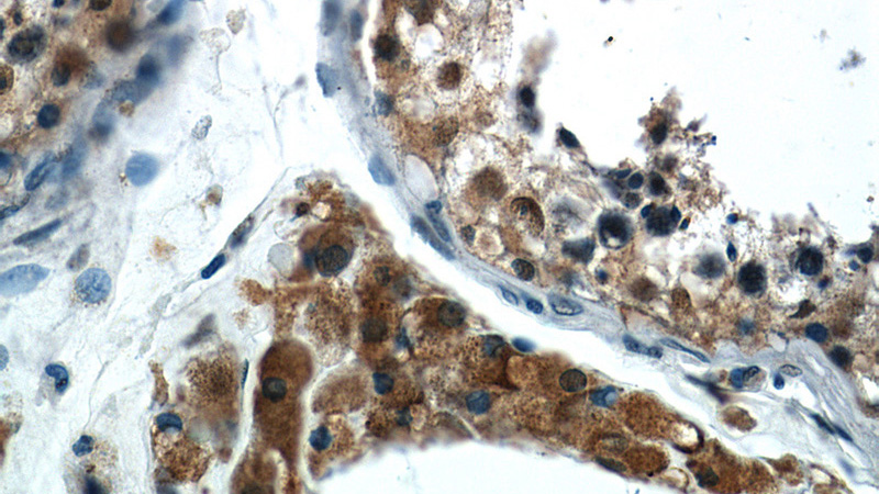 Immunohistochemistry of paraffin-embedded human testis slide using Catalog No:109180(CEP350-Specific Antibody) at dilution of 1:50