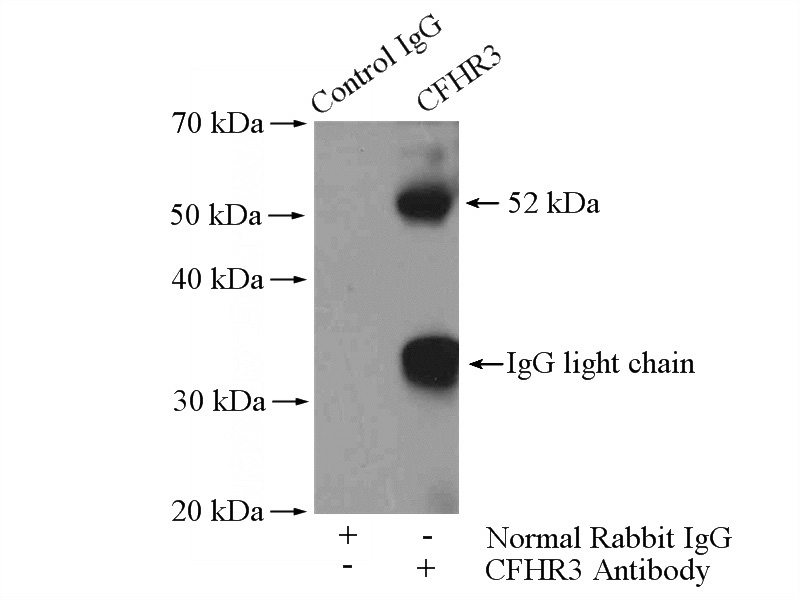 IP Result of anti-CFHR3 (IP:Catalog No:109198, 4ug; Detection:Catalog No:109198 1:300) with HepG2 cells lysate 2400ug.
