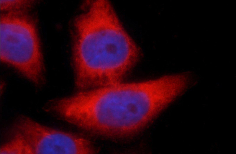 Immunofluorescent analysis of HeLa cells using Catalog No:112309(LPP Antibody) at dilution of 1:25 and Rhodamine-Goat anti-Rabbit IgG