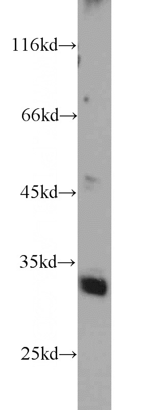 human brain tissue were subjected to SDS PAGE followed by western blot with Catalog No:110597(FAM71E2 antibody) at dilution of 1:1000