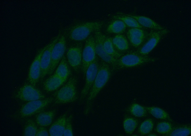 Immunofluorescent analysis of (10% Formaldehyde) fixed HeLa cells using Catalog No:112524(MEX3C Antibody) at dilution of 1:50 and Alexa Fluor 488-congugated AffiniPure Goat Anti-Rabbit IgG(H+L)
