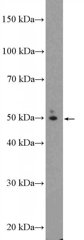 mouse brain tissue were subjected to SDS PAGE followed by western blot with Catalog No:115863(TBC1D19 Antibody) at dilution of 1:1000