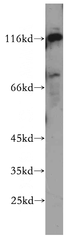 HeLa cells were subjected to SDS PAGE followed by western blot with Catalog No:112046(KIAA0319L antibody) at dilution of 1:500