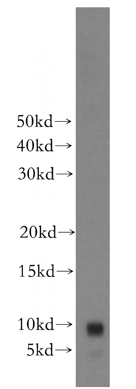 Jurkat cells were subjected to SDS PAGE followed by western blot with Catalog No:108981(CCDC56 antibody) at dilution of 1:300