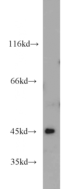 MCF7 cells were subjected to SDS PAGE followed by western blot with Catalog No:108060(ANGPTL7 antibody) at dilution of 1:800