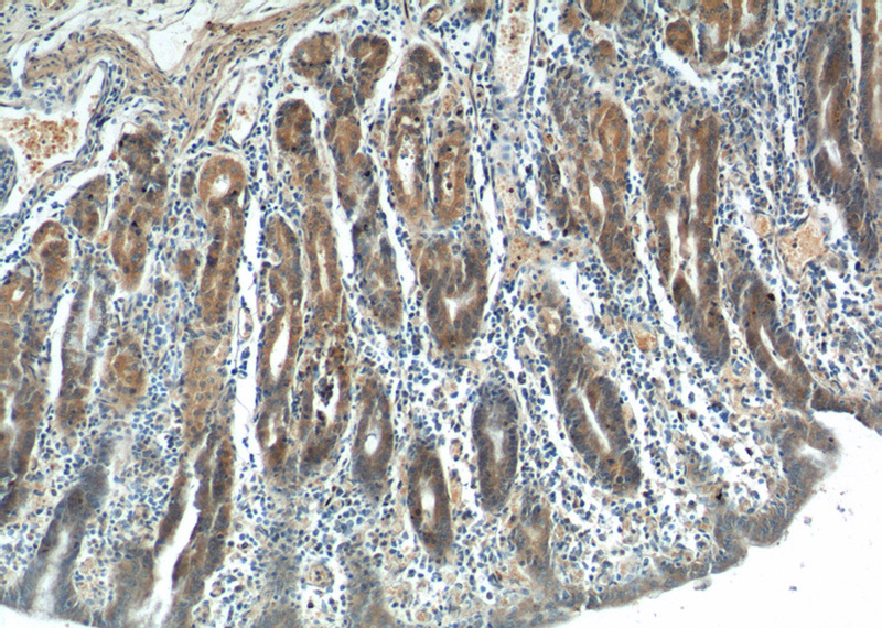 Immunohistochemistry of paraffin-embedded human stomach tissue slide using Catalog No:110635(FGF5 Antibody) at dilution of 1:200 (under 10x lens).
