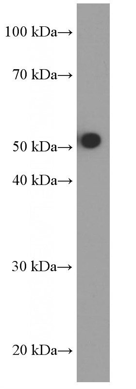 human testis tissue were subjected to SDS PAGE followed by western blot with Catalog No:107262(HEXIM1 Antibody) at dilution of 1:1000