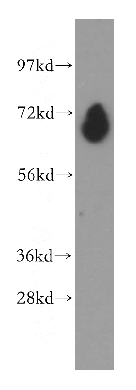 human heart tissue were subjected to SDS PAGE followed by western blot with Catalog No:113658(PDE1C antibody) at dilution of 1:500