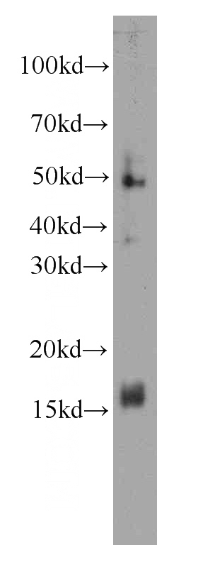 human cerebellum tissue were subjected to SDS PAGE followed by western blot with Catalog No:107216(FKBP2 antibody) at dilution of 1:500