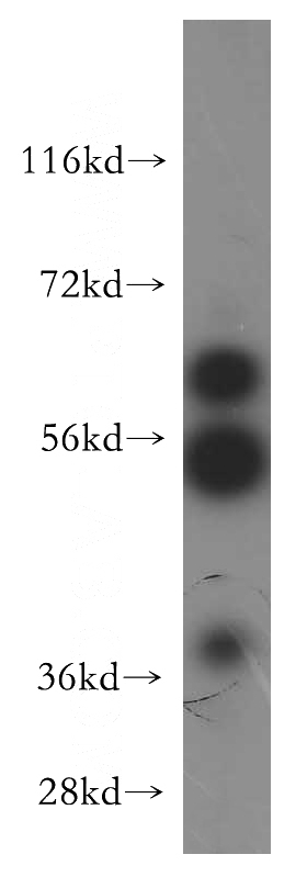 mouse kidney tissue were subjected to SDS PAGE followed by western blot with Catalog No:116591(USP14 antibody) at dilution of 1:300