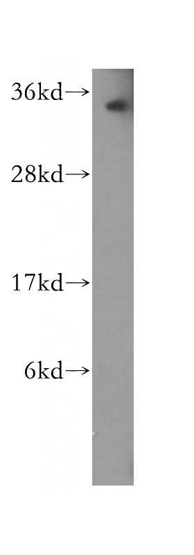 Raji cells were subjected to SDS PAGE followed by western blot with Catalog No:113985(PNRC1 antibody) at dilution of 1:500