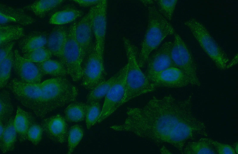 Immunofluorescent analysis of (10% Formaldehyde) fixed HeLa cells using Catalog No:110711(FOXP3 Antibody) at dilution of 1:50 and Alexa Fluor 488-congugated AffiniPure Goat Anti-Rabbit IgG(H+L)