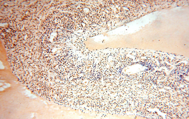 Immunohistochemical of paraffin-embedded human ovary using Catalog No:115856(TASP1 antibody) at dilution of 1:100 (under 10x lens)